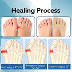 Orthoes™ Bunion Relief Socks